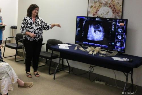 Ultrasound Demonstration